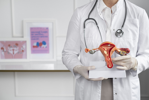 Berita perusahaan terbaru tentang Endometriosis Sangat Terkait dengan Risiko Kanker Ovarium yang Tinggi