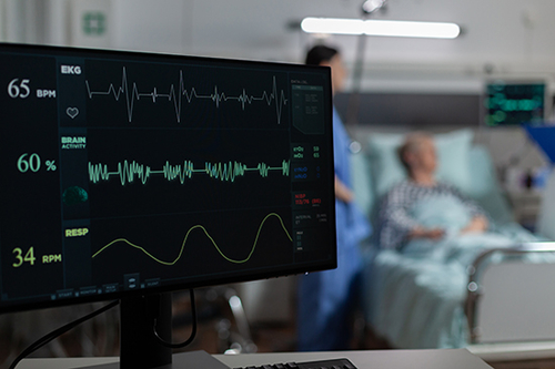 Blog perusahaan terbaru tentang Memahami Atrial Fibrillation (AFib)