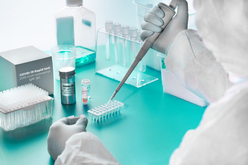 Latest company news about Pengaruh Imunoglobulin (IgA, IgG, IgM)