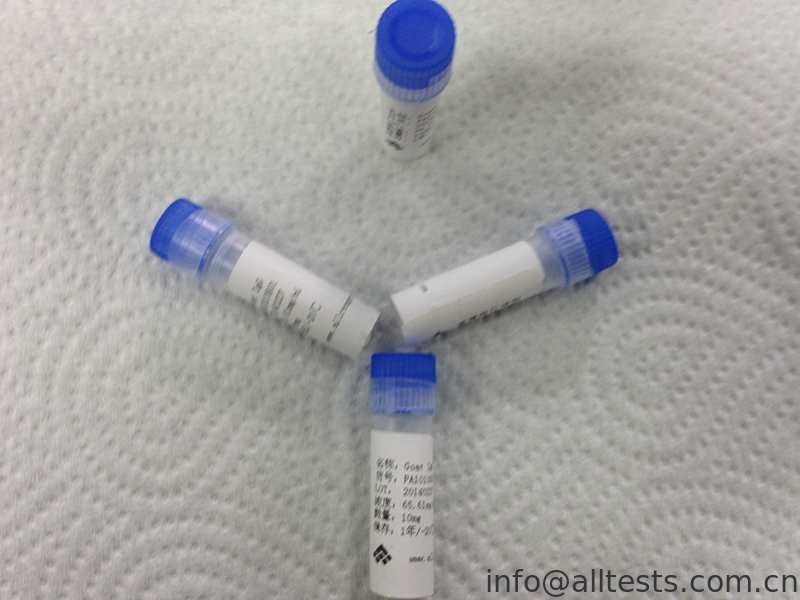 Medical IgG Goat Polyclonal Anti body Custom Polyclonal Antibodies For Vitro Diagnostic